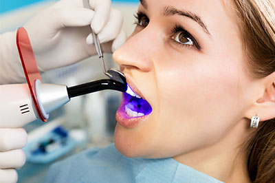 A woman receiving dental treatment with a dental mirror and blue dye for visualization.