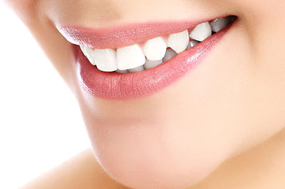 A close-up photo of a person s face with a focus on their teeth, showcasing dental implants.