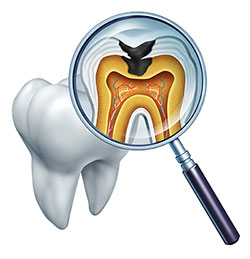 The image shows a magnified view of a human tooth with its root structure visible through a transparent window, accompanied by a dental magnifier and a small illustration of a cross-sectioned tooth with color-coded areas indicating different dental tissues.